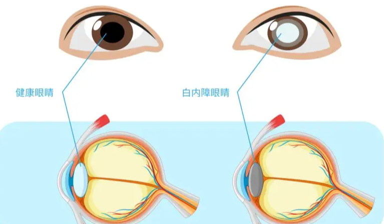 汉阳艾格眼科患者反馈好