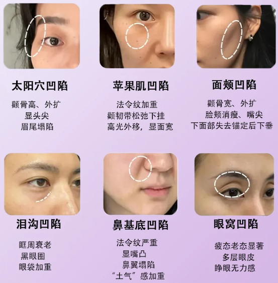 朴洪权全脸微调价格表