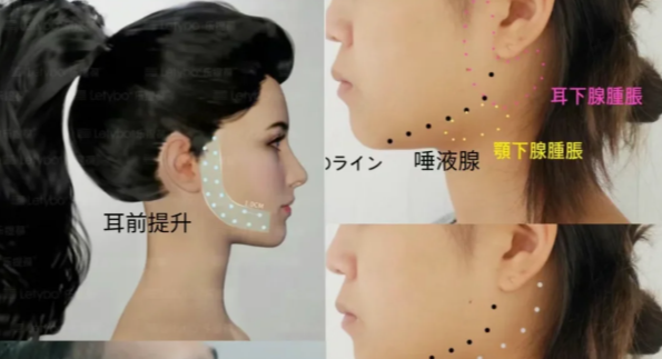 朴洪权全脸微调性价比高