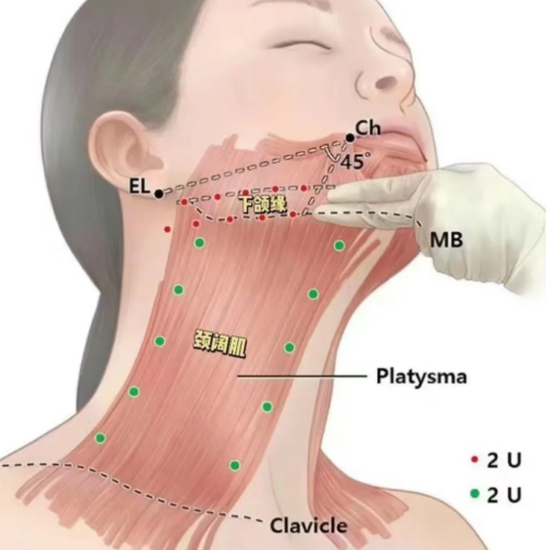 朴洪权医生的面部微调技术怎么样?