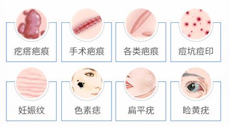 杭州治療疤痕專門醫(yī)院有哪些