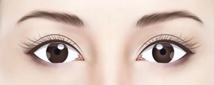 上海刘平双眼皮改单的价格