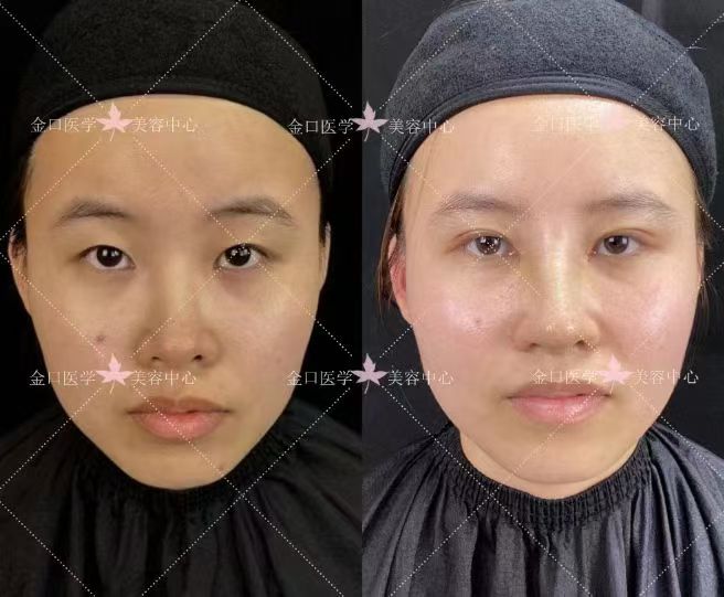 八、烟台白玉口腔医院价格情况