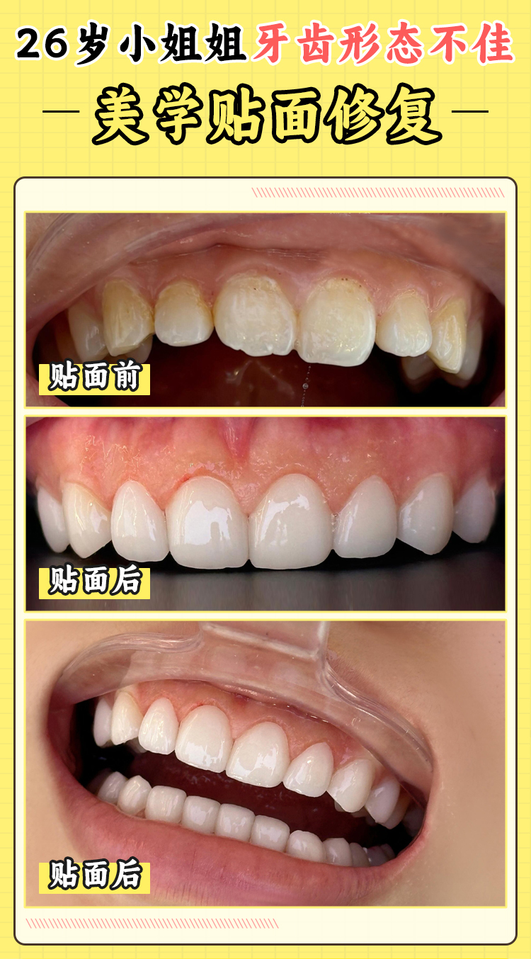 七、新乡植得口腔医院是正规医院吗之收费情况揭秘