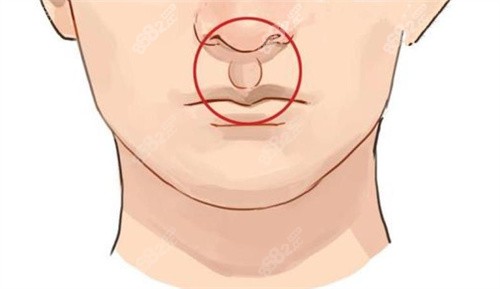 王曉健醫(yī)生人中縮短 王曉健醫(yī)生人中縮短