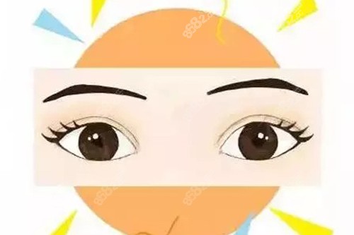 成功双眼皮示意图 成功双眼皮示意图