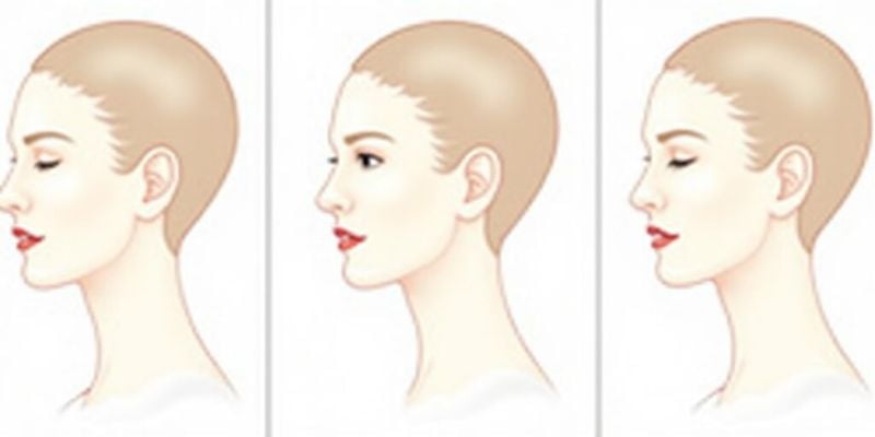 王易彬明星實例分享：從平淡到驚艷的轉(zhuǎn)變