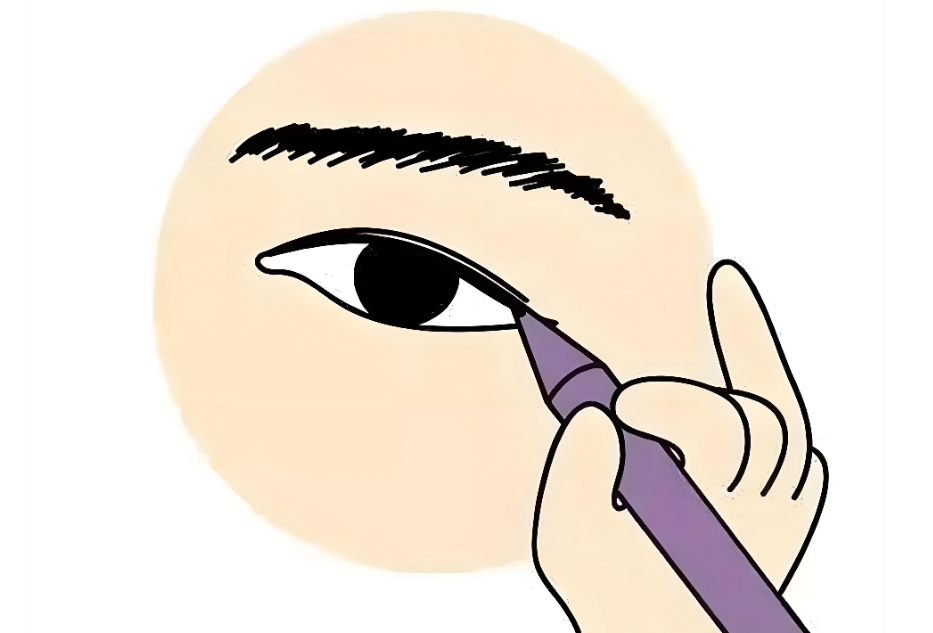 北京张菡单眼皮上睑年轻化