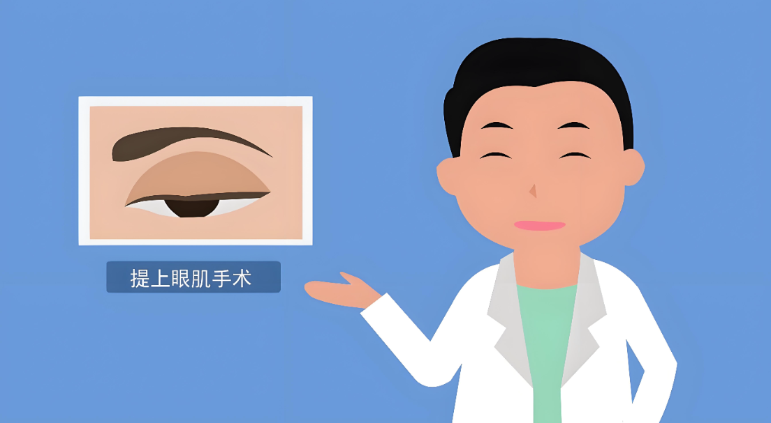 张菡双眼皮改单眼皮失败实例无:好评背后的四层缝合技术,30天变回自然单眼皮!