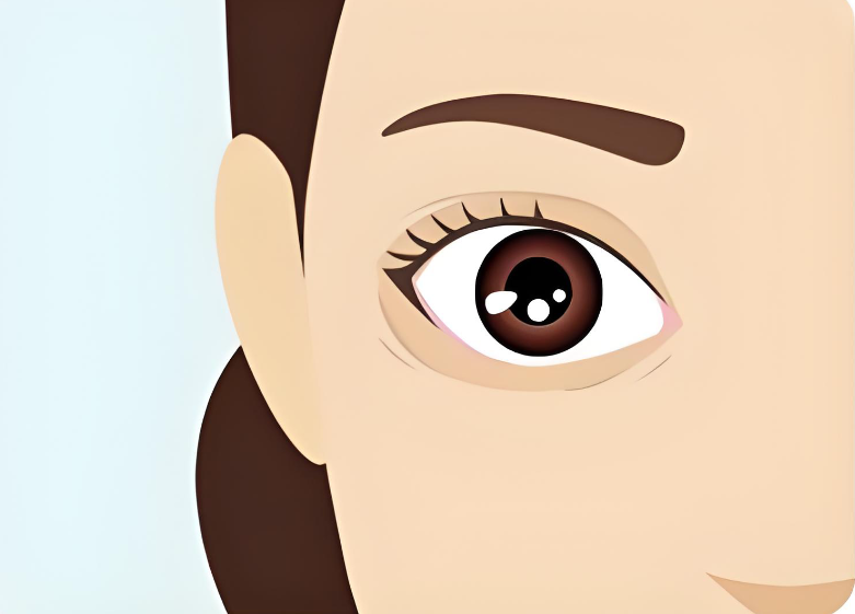 张菡双眼皮改单眼皮www.8682.cc