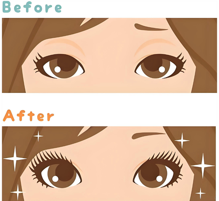 张菡双眼皮改单眼皮如何