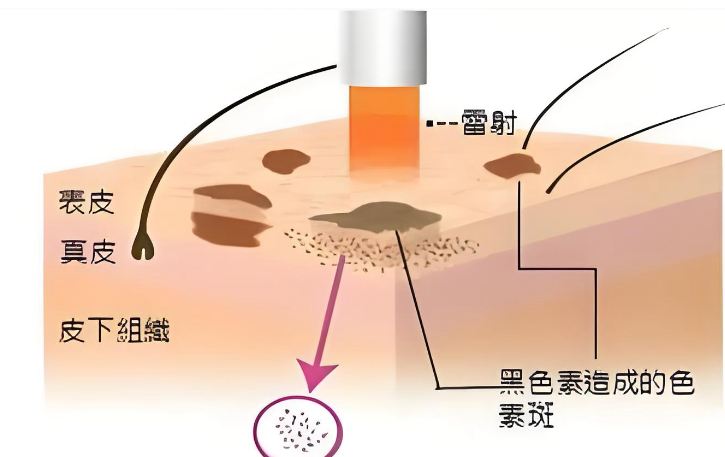 韓國Schedule Clinic皮膚科評價(jià)如何