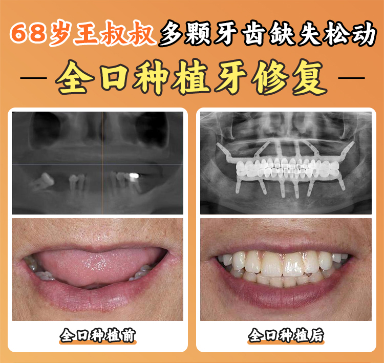 四、寧波好牙引領(lǐng)口腔醫(yī)院口碑怎么樣？患者特別信賴