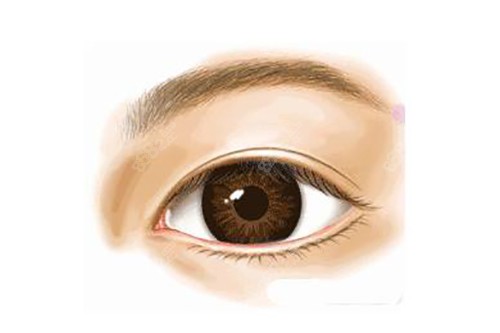 20251105122851.jpg 真实双眼皮示意图.jpg