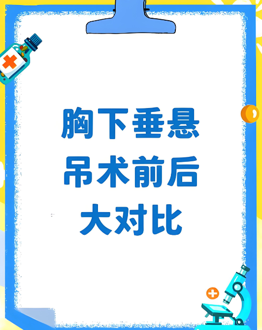 徐国建做乳房悬吊手术靠谱吗www.8682.cc