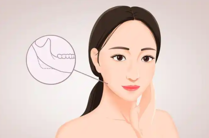 上海磨骨郑康在哪个医院?就医建议