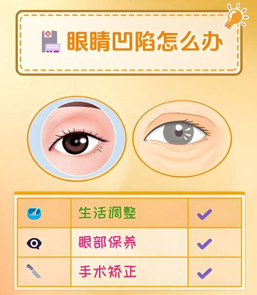 长沙张娇娇做眼窝凹陷手术怎么样