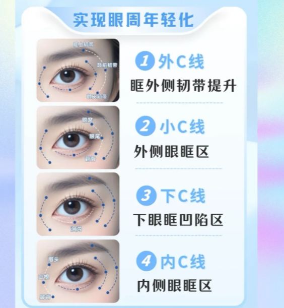上海朱维玲医生眼周筋膜悬吊术:4类“眼垮”人群刚好适合