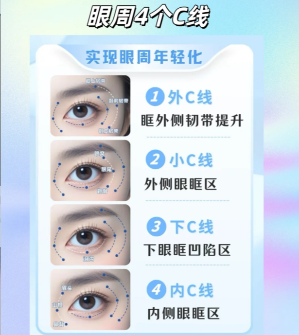 朱维玲眼周筋膜悬吊好吗