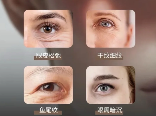做朱维玲眼周筋膜悬吊前,这些真实注意事项要提前知道