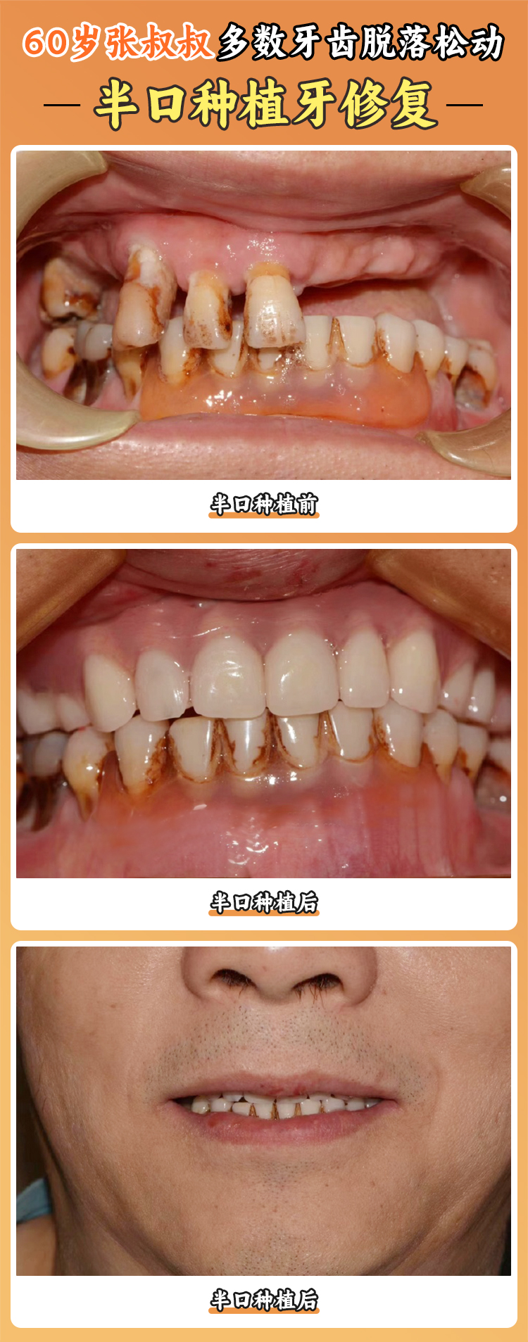 四、患者实例分享