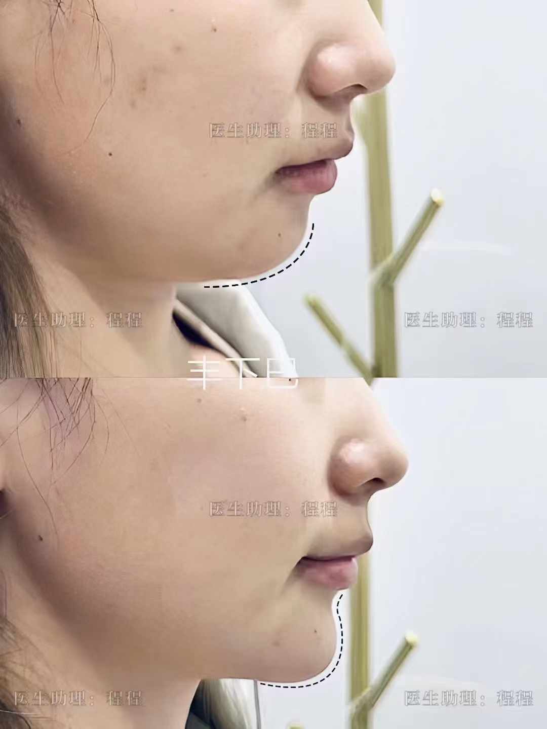 北京美冠塔口腔医院是公立医院吗？私立性质却凭优质服务与技术成患者信赖之选 