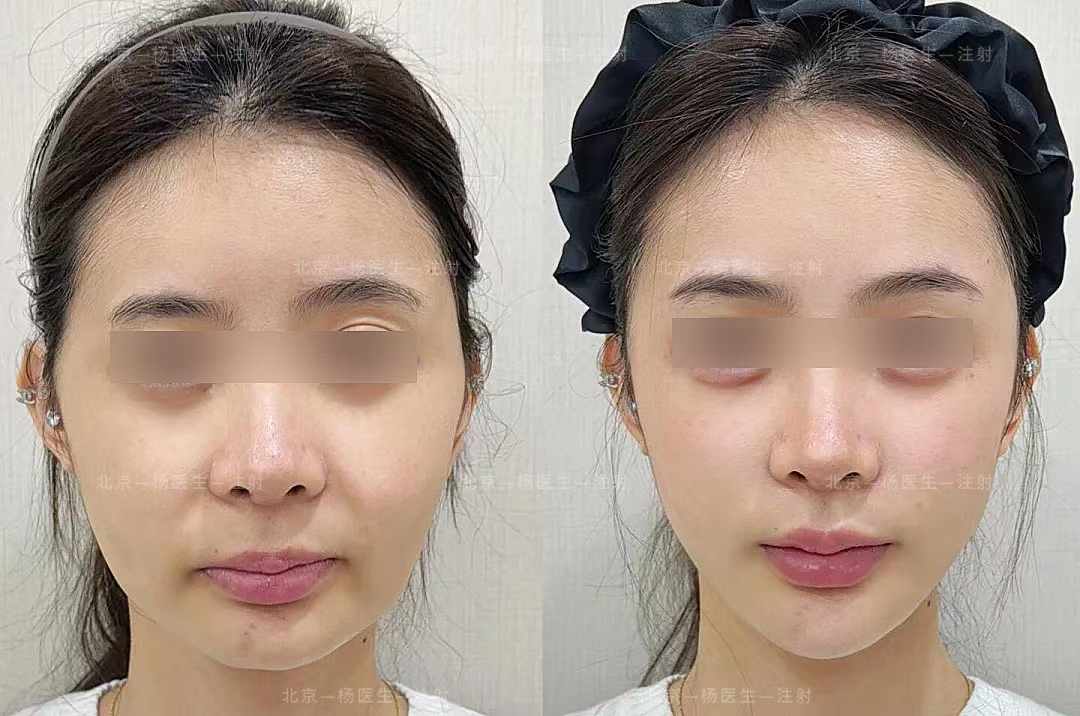 三、判断北京美冠塔口腔医院诊疗服务专精度的关键要素