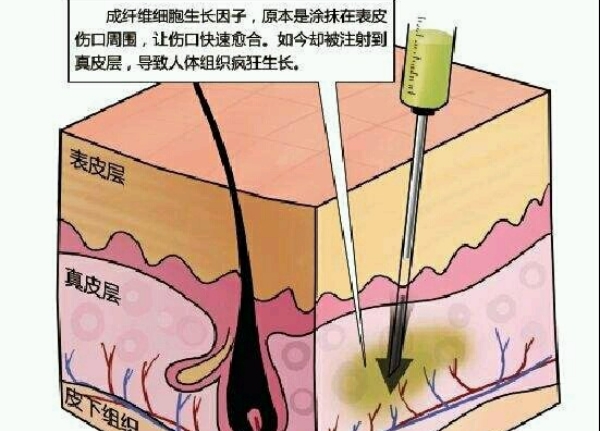 张立彬医生助理生长因子就诊