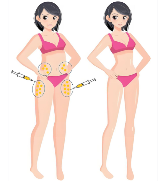 上海安禾美閣找陳文龍抽脂怎么樣