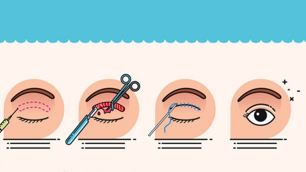 呼市双眼皮修复价格表www.8682.cc