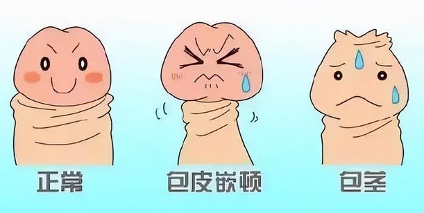 李世荣医生做阴茎延长手术的优势