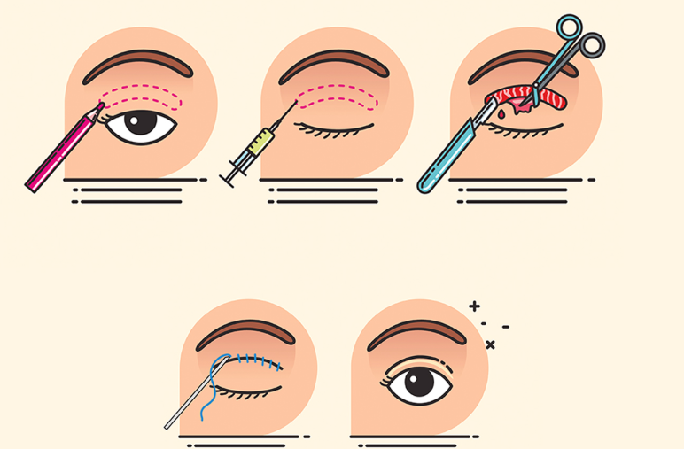 金華金東韓美整形正規(guī)嗎？口碑方面