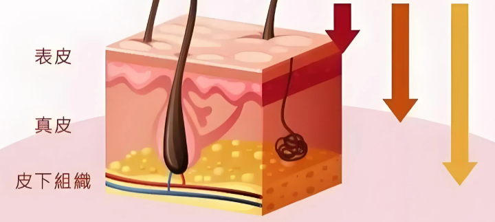 寧波媛藝醫(yī)療超皮秒祛斑怎么樣？有經(jīng)驗比較豐富的祛斑醫(yī)生