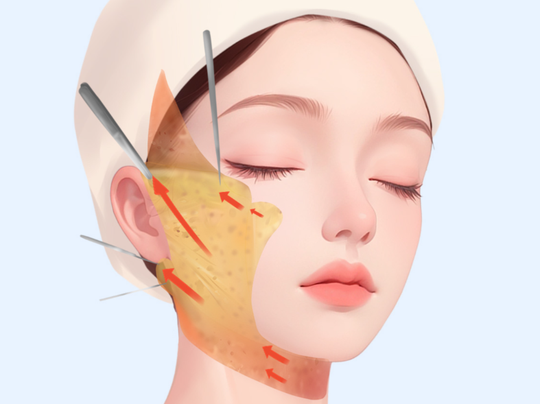 張永雙燕尾怎么聯(lián)系