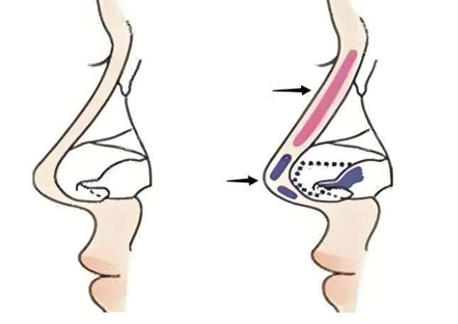 成都李瑞萱野生范例