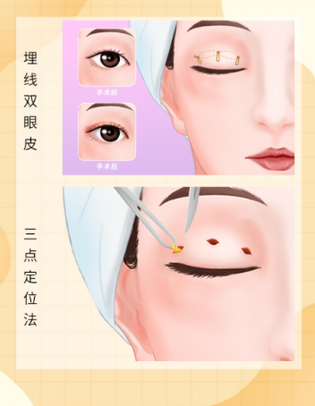 成都李瑞萱野生范例