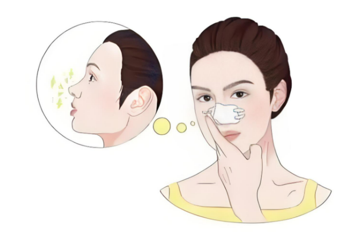 上海熊裕華做鼻子修復怎么樣