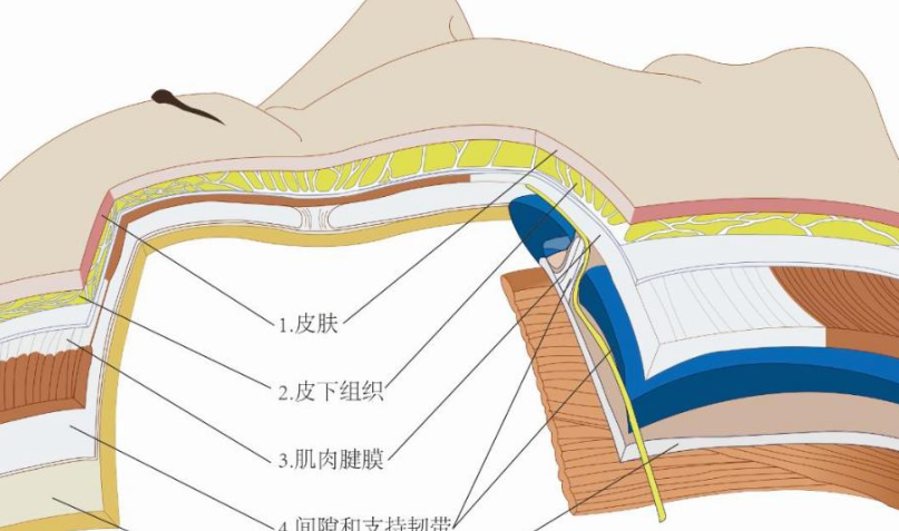 手術類和打針類皮貼骨提升的