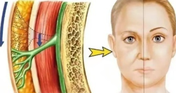 皮貼骨提升到底是手術還是打針