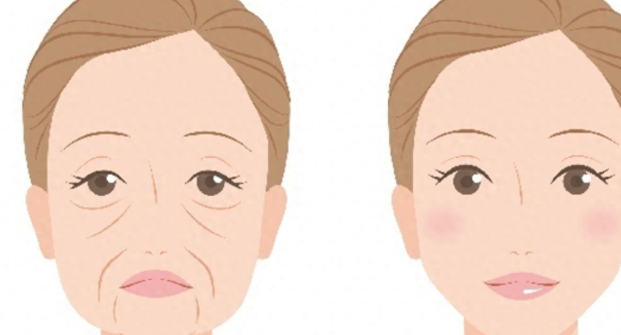 广州做面部提升出名医院