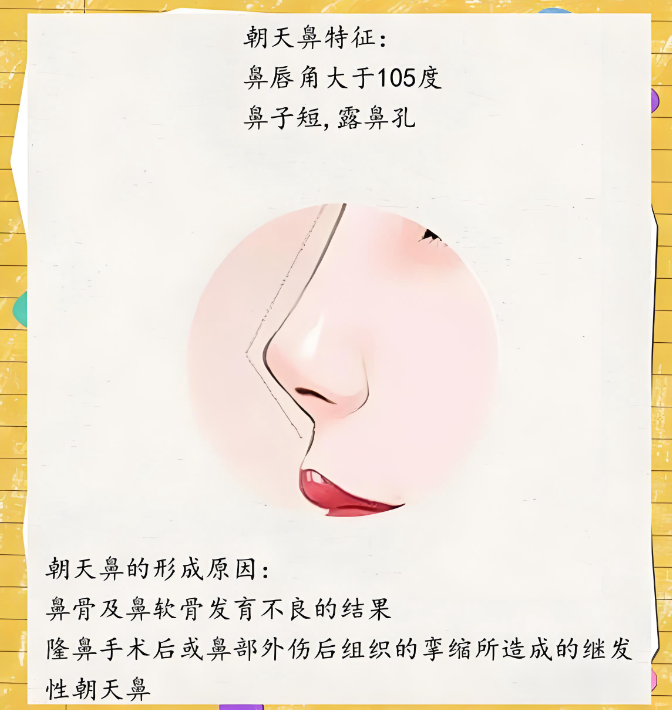 彭鑫医生的朝天鼻矫正怎么样