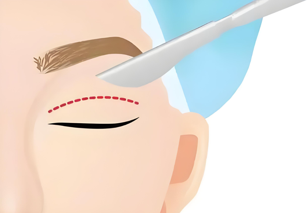 何文星修复眼睛如何