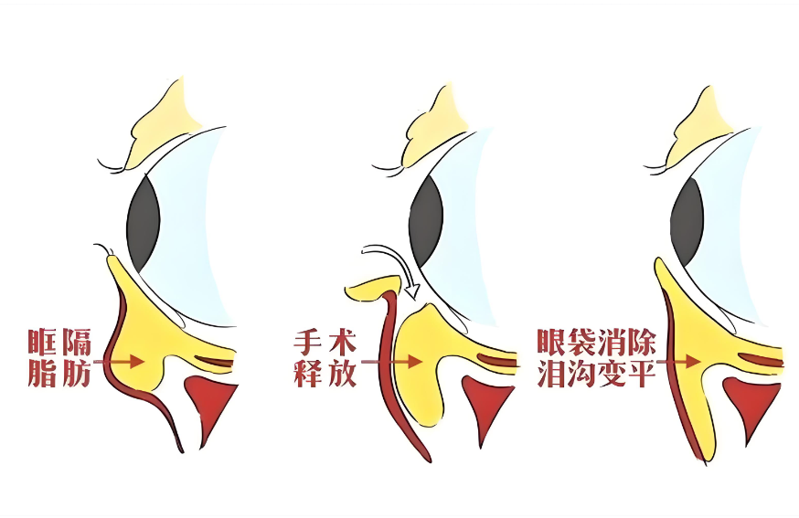 何文星专注眼整形医院位置大公开：要去面诊的姐妹收好！就在长沙市韶山北路...