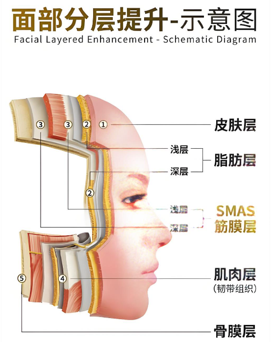 韩国的筋膜提升和国内做法一样吗