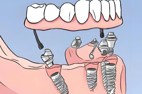 上海青浦口腔医院排名前十公布！这些医院技术先进服务好是真的吗？ 