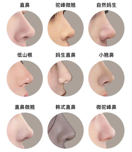 上海熊裕华医生肋骨鼻修复实例参考