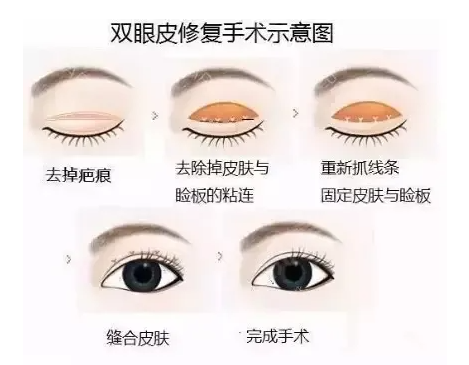 上海周美兰和朱迪修复眼睛谁好