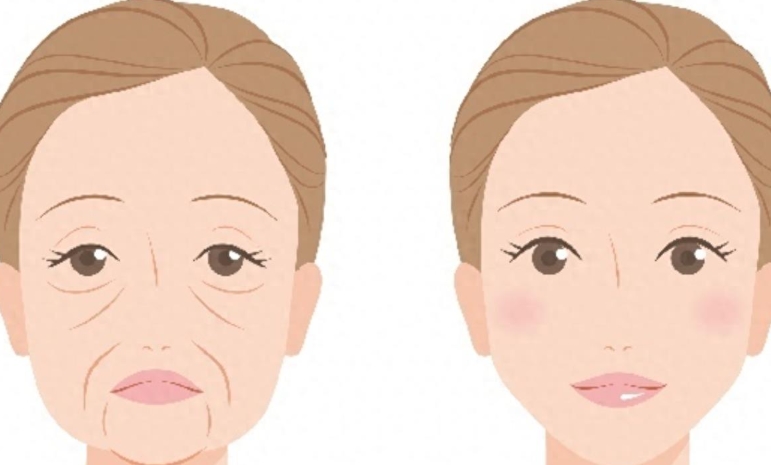 穆寶安面部提升多久消腫