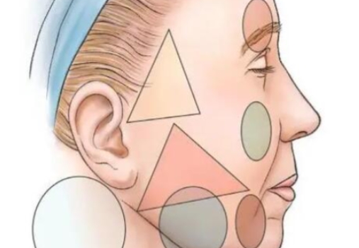 穆寶安面部提升多久消腫