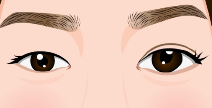 華美美萊8d雙眼皮團(tuán)購(gòu)價(jià)格